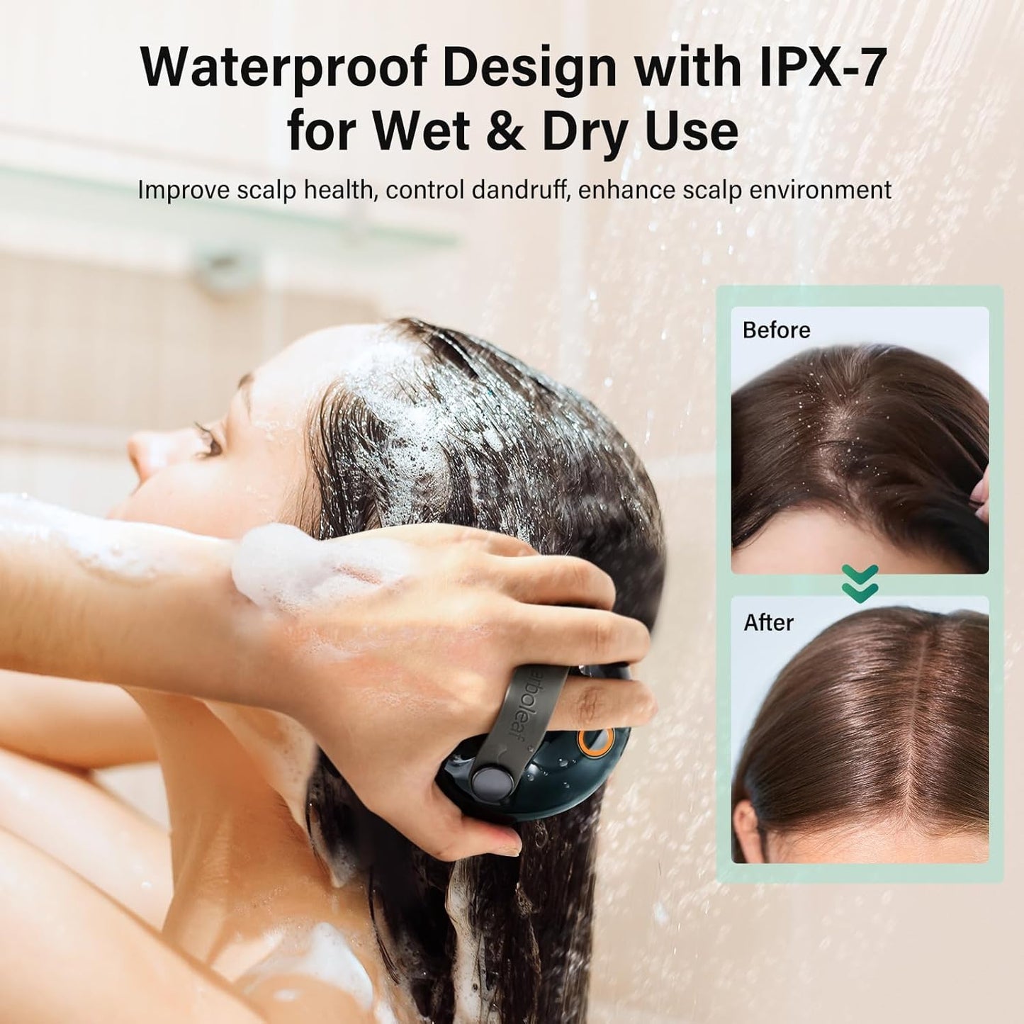 Arboleaf scalp massager